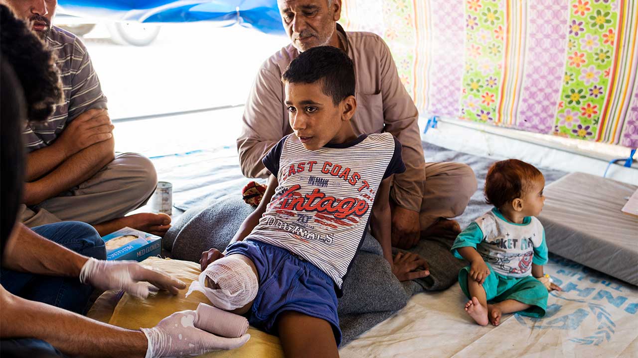 Abdel Rahman, 12, had his leg amputated after a shell exploded on his house. He is receiving care from an HI physiotherapist.